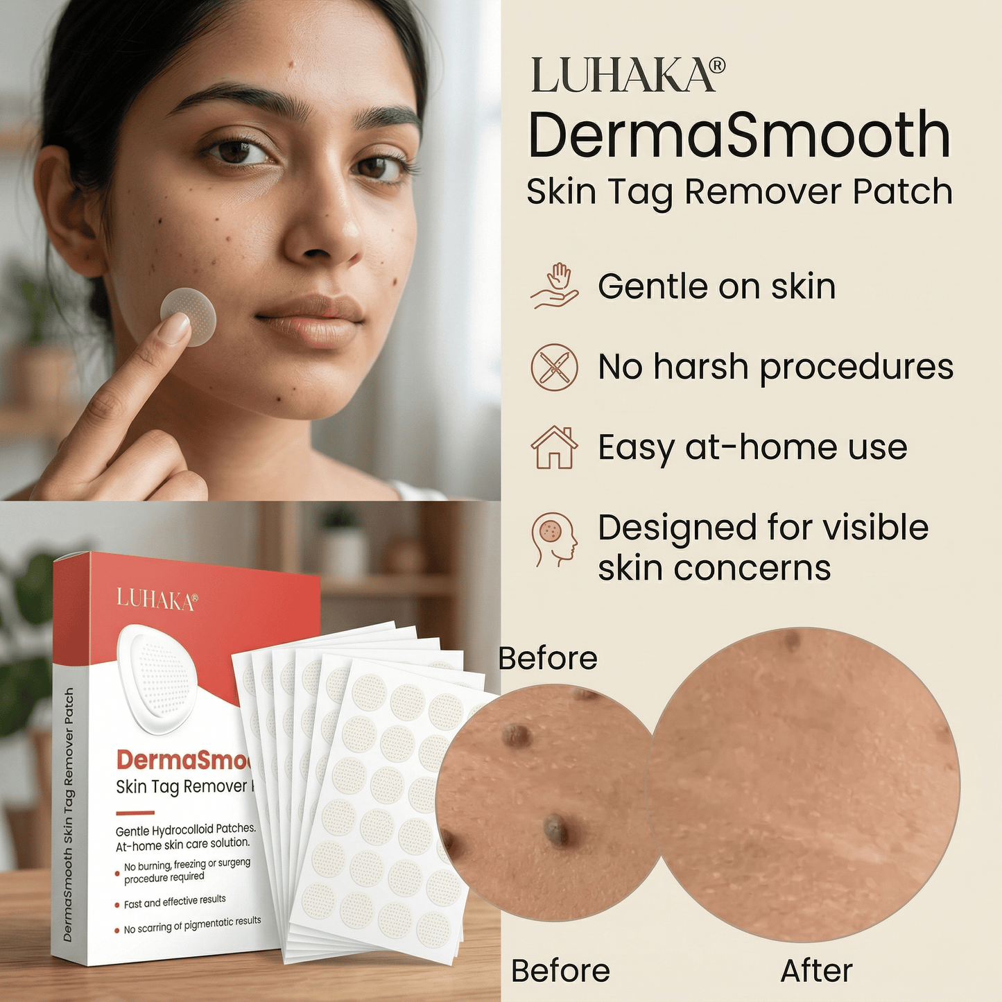DermaSmooth - Tag & Mole Remover