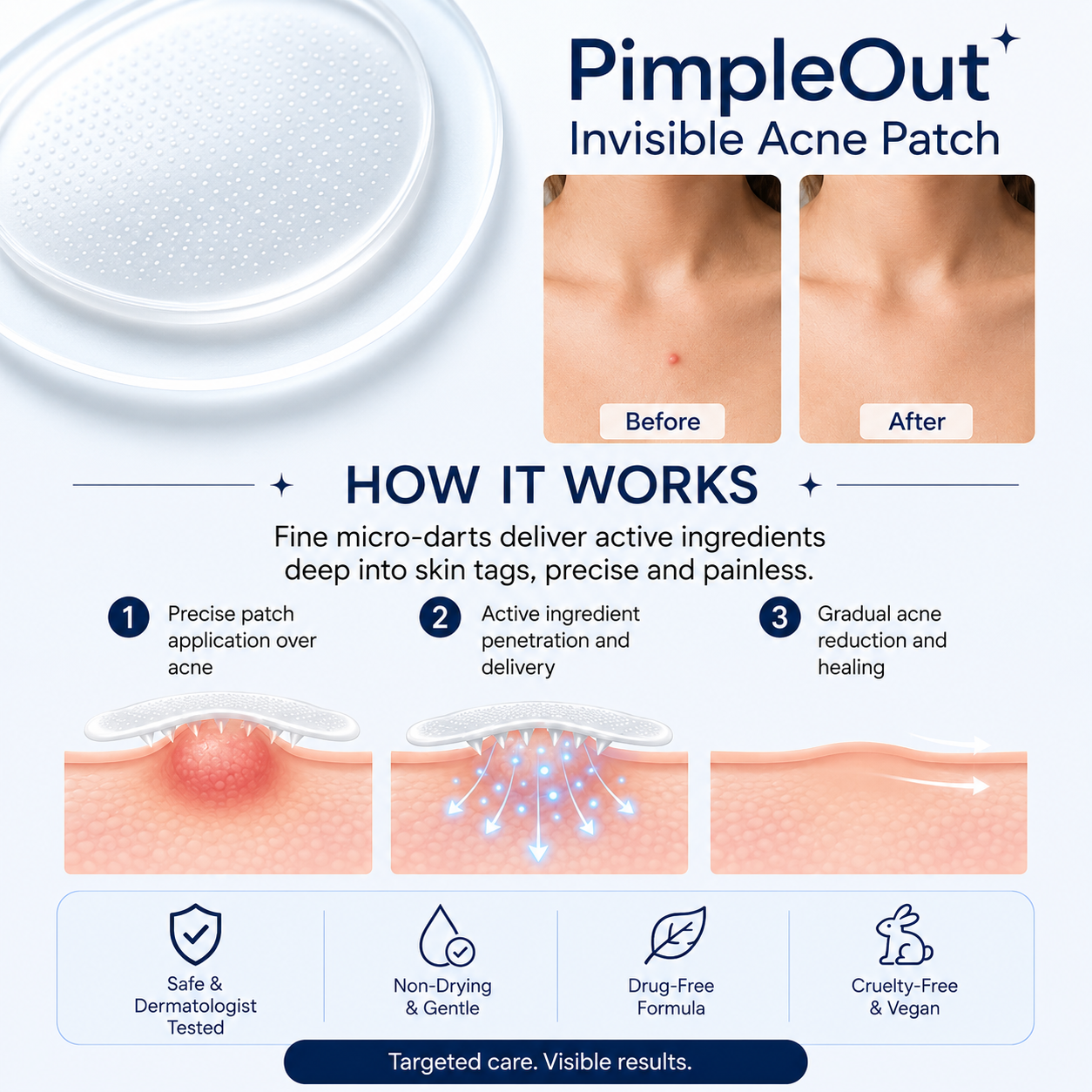 PimpleOut™ – Invisible Acne Patch