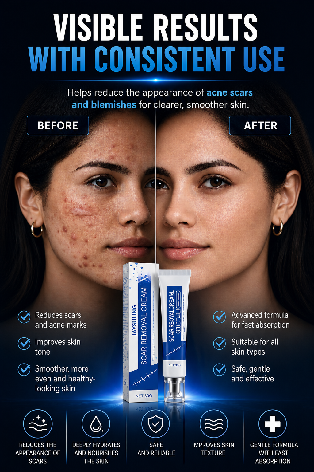 ScarSmooth™- Great for all types of marks